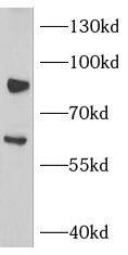 NOX5 Antibody - BSA Free