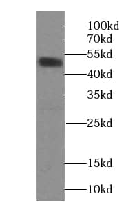 NOX3 Antibody - BSA Free