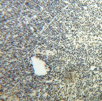 NOL1 Antibody - BSA Free