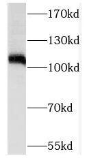 NOL1 Antibody - BSA Free