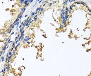 Neuroligin 4Y/NLGN4Y Antibody - BSA Free
