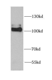 Neuroligin 4Y/NLGN4Y Antibody - BSA Free