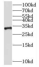 NKX1-2 Antibody - BSA Free