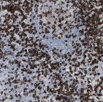 NIPSNAP3B Antibody - BSA Free