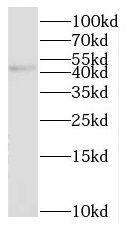 NHLRC1 Antibody - BSA Free