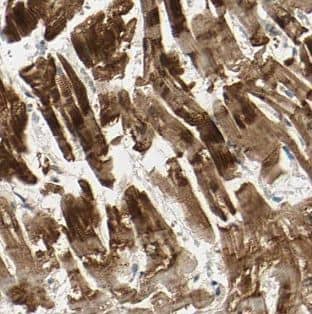 NAV1 Antibody - BSA Free