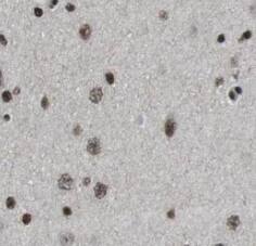 Neuromedin B Antibody - BSA Free