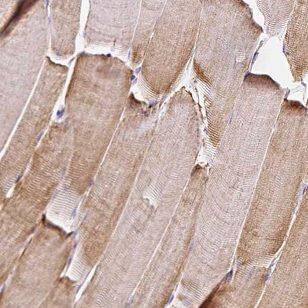 NEURL2 Antibody - BSA Free