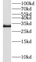 NEURL2 Antibody - BSA Free