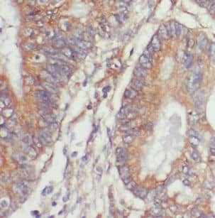 NET1 Antibody - BSA Free