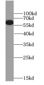 WHSC2 Antibody - BSA Free
