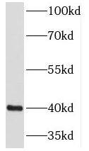 NECAP1 Antibody - BSA Free