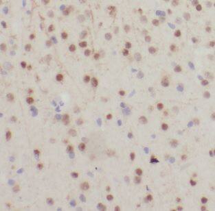 NDUFB7 Antibody - BSA Free