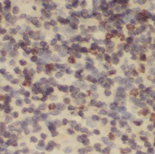NDUFB2 Antibody - BSA Free