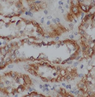 NDUFB1 Antibody - BSA Free