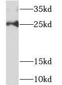 NDUFAF2 Antibody - BSA Free