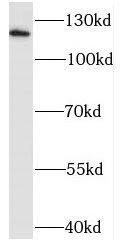 Sodium Calcium Exchanger 1/NCX1 Antibody - BSA Free