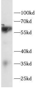 SLC38A2 Antibody - BSA Free