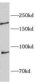 SLC4A10 Antibody - BSA Free