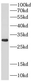 WBSCR27 Antibody - BSA Free