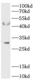 RPUSD4 Antibody - BSA Free