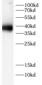 GADD34 Antibody - BSA Free