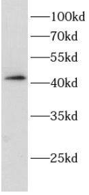 MAGEB18 Antibody - BSA Free