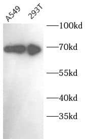 MAGED2 Antibody - BSA Free