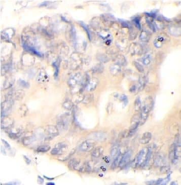 Proprotein convertase PC4 Antibody - BSA Free
