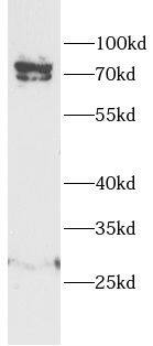 Proprotein convertase PC4 Antibody - BSA Free