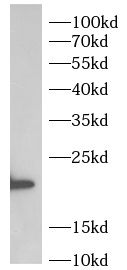 UCK2 Antibody - BSA Free