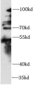 ZNF746 Antibody - BSA Free