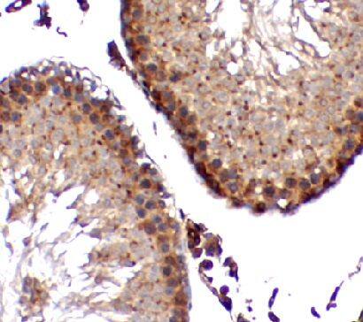 ZNF746 Antibody - BSA Free