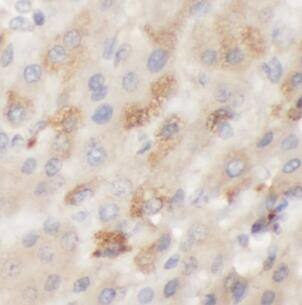 Galactosylceramidase/GALC Antibody - BSA Free