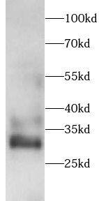 Galactosylceramidase/GALC Antibody - BSA Free