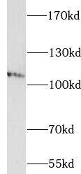 IQSEC1 Antibody - BSA Free