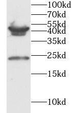 PMCH Antibody - BSA Free