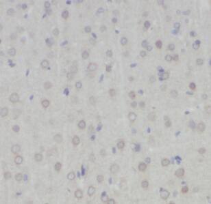 5-HT1A Antibody - BSA Free