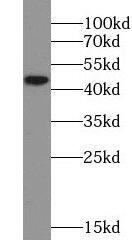 5-HT1A Antibody - BSA Free