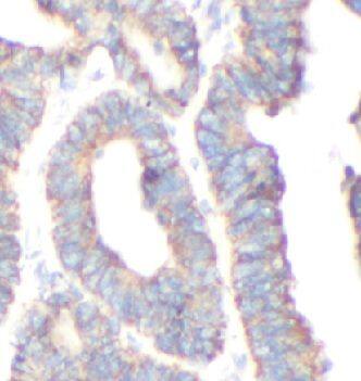 FOXO6 Antibody - BSA Free