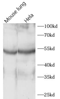 ACOXL Antibody - BSA Free