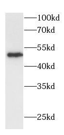 DDX25 Antibody - BSA Free