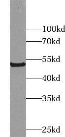 ZNF446 Antibody - BSA Free