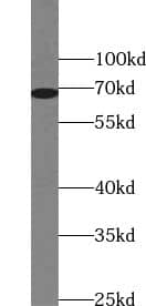 ZNF410 Antibody - BSA Free