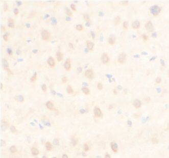 ARPC5L Antibody - BSA Free