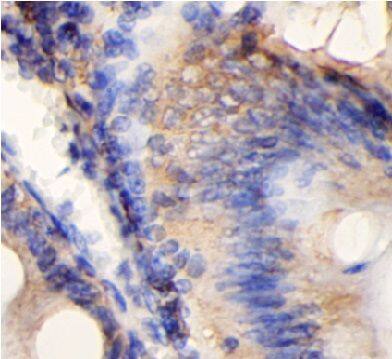CHM Antibody - BSA Free
