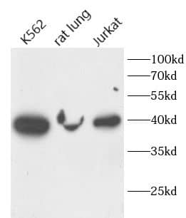 Fucosyltransferase 2/FUT2 Antibody - BSA Free