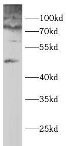 Glycogen synthase 2 Antibody - BSA Free