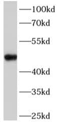 Fatty acid desaturase 2 Antibody - BSA Free
