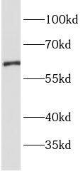 OAT1 Antibody - BSA Free